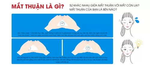 Mắt thuận là gì?